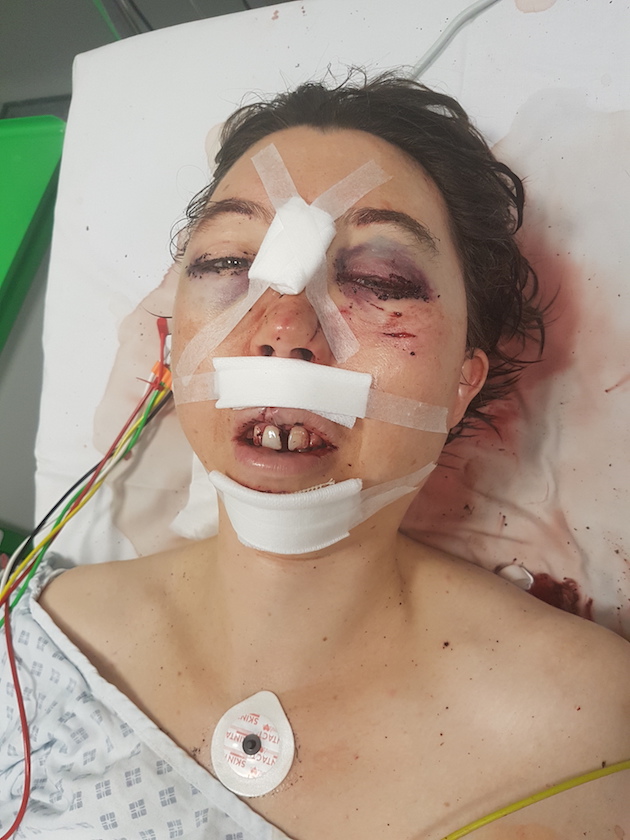 d1postaccident.jpg