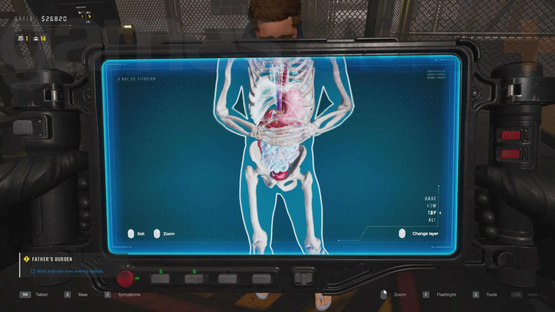 Diagnosing Quarantine Zone symptoms using the x-ray