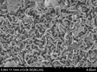 An electron micrograph of SAR11 bacteria strain HIMB4 cultured from Kaneohe Bay, Oahu, Hawaii.