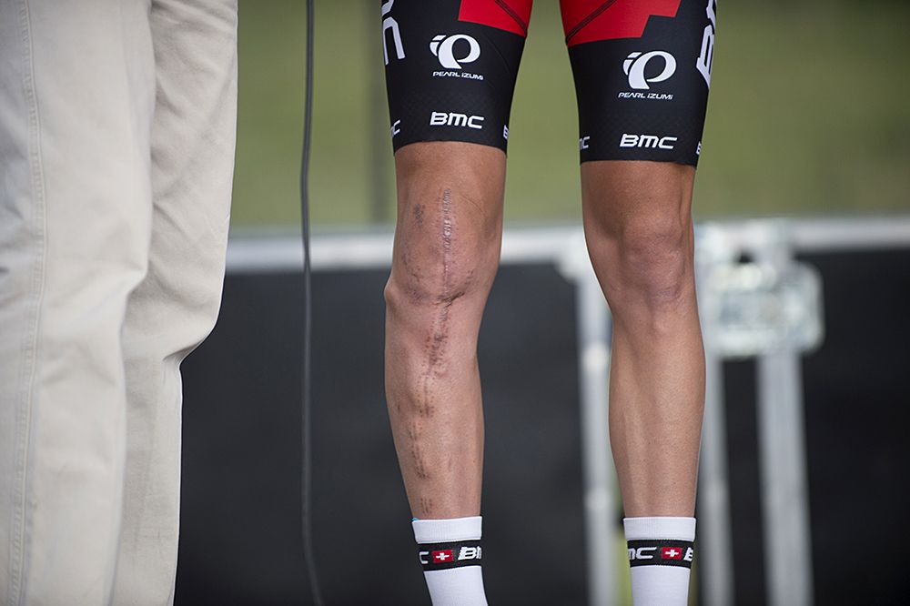 Peter Stetina (BMC) continues to make his comeback from a horrific leg injury