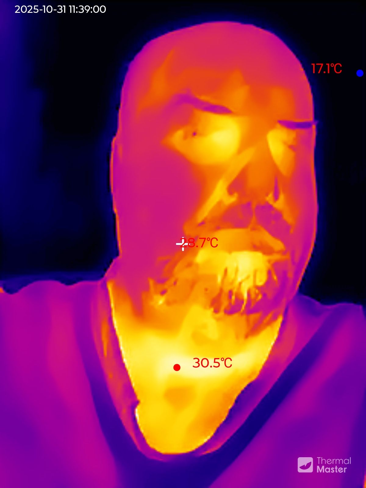 Thermal Master P1 Example captures