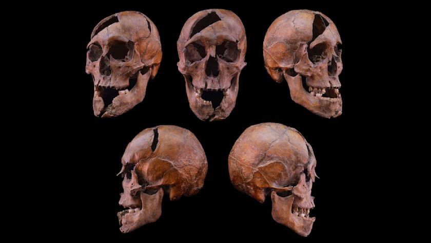 Multiple angles of a skull with large holes and cracks