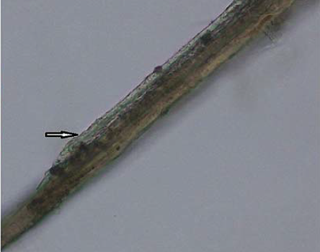 This image shows the tubular body of the worm under high microscopic magnification after it was removed from the man’s eye.