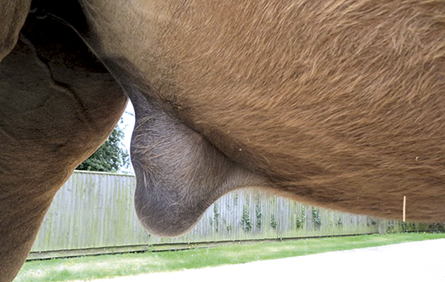 From the outside an umbilical hernia appears as a skin sac and is usually soft and painless
