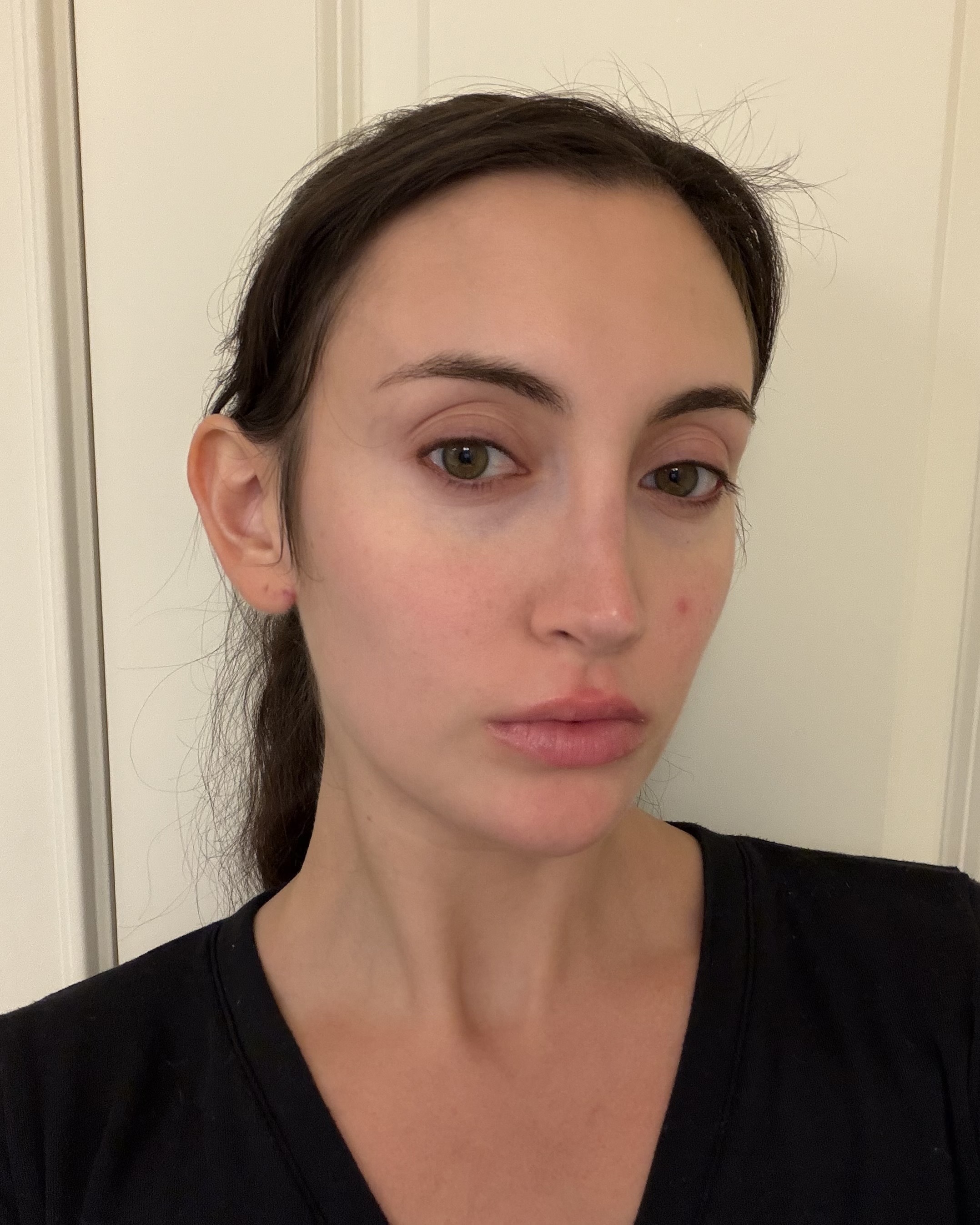 Who What Wear associate beauty editor Alyssa Brascia before using the Omnilux Contour Face Mask.