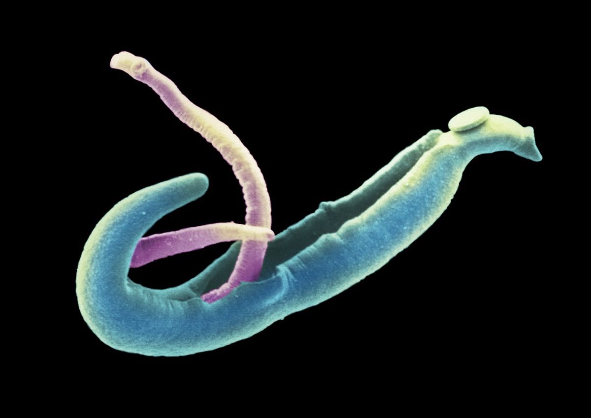 Why 17 People Volunteered To Be Infected With Parasitic Worms Live Science