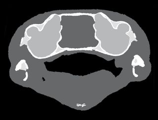 This image shows a segment of a frog's head, displaying the two inner ears (light grey), the brain in between, and the buccal cavity beneath.