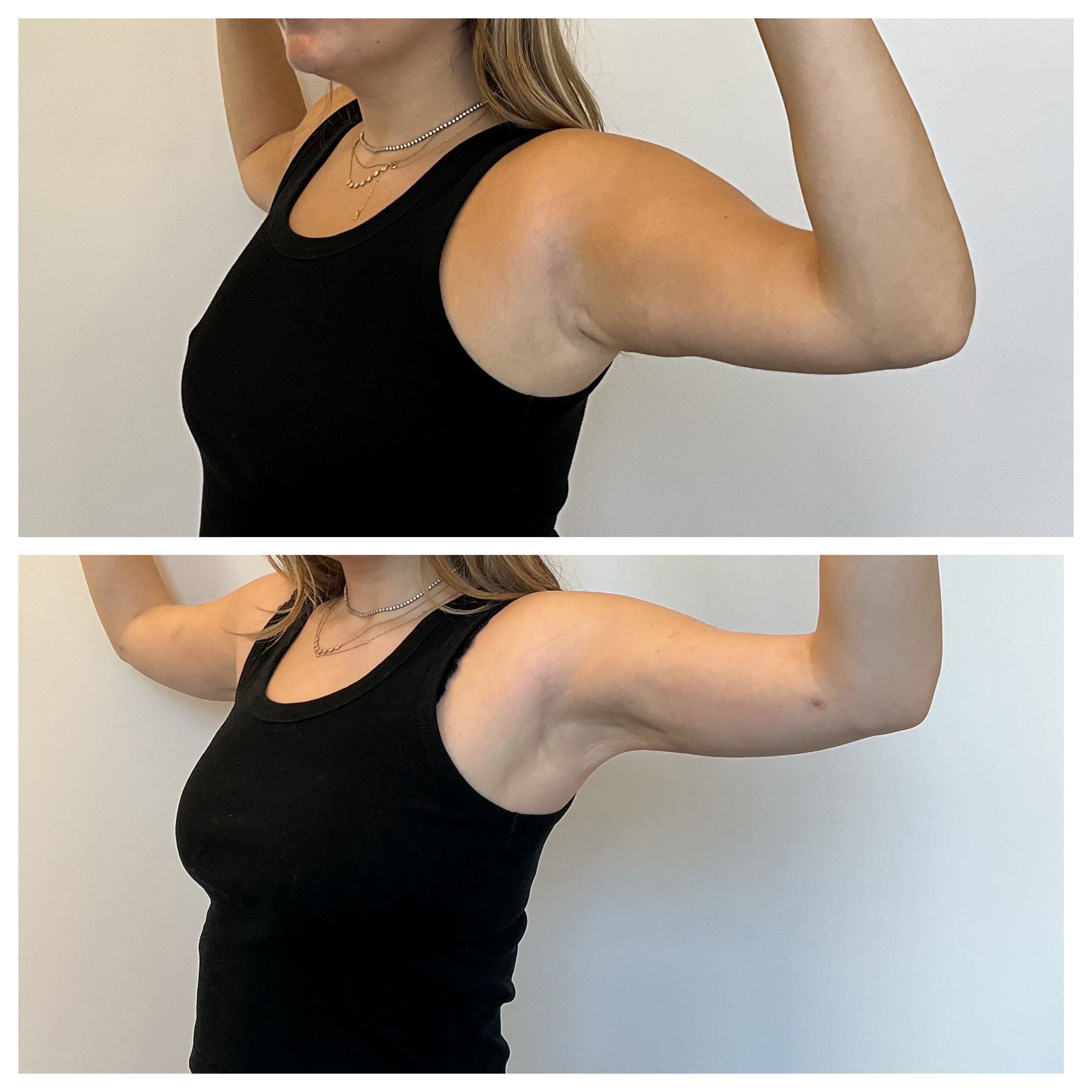 samantha holender before and after surgery