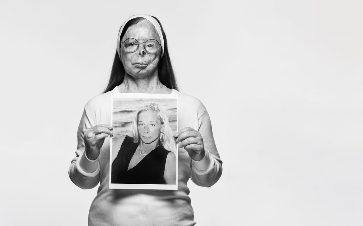 Rankin shoots powerful photos for global campaign to end acid violence