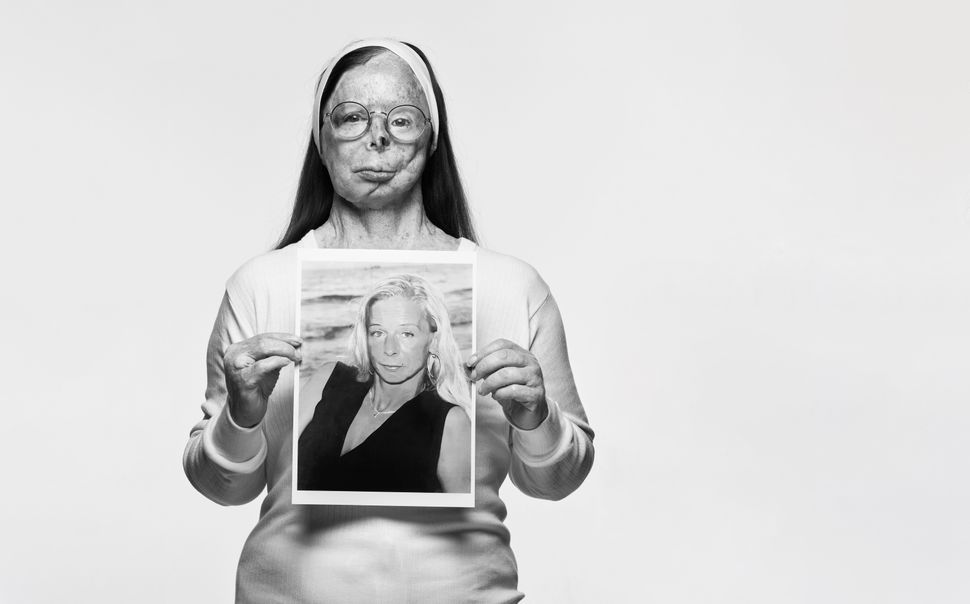 Rankin shoots powerful photos for global campaign to end acid violence ...