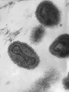 The dumbbell-shaped structure inside smallpox contains viral DNA.