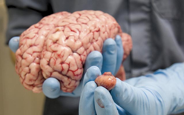 2-brain-showing-small-pituatory-gland-mconie-PPID-brain-wt.jpg