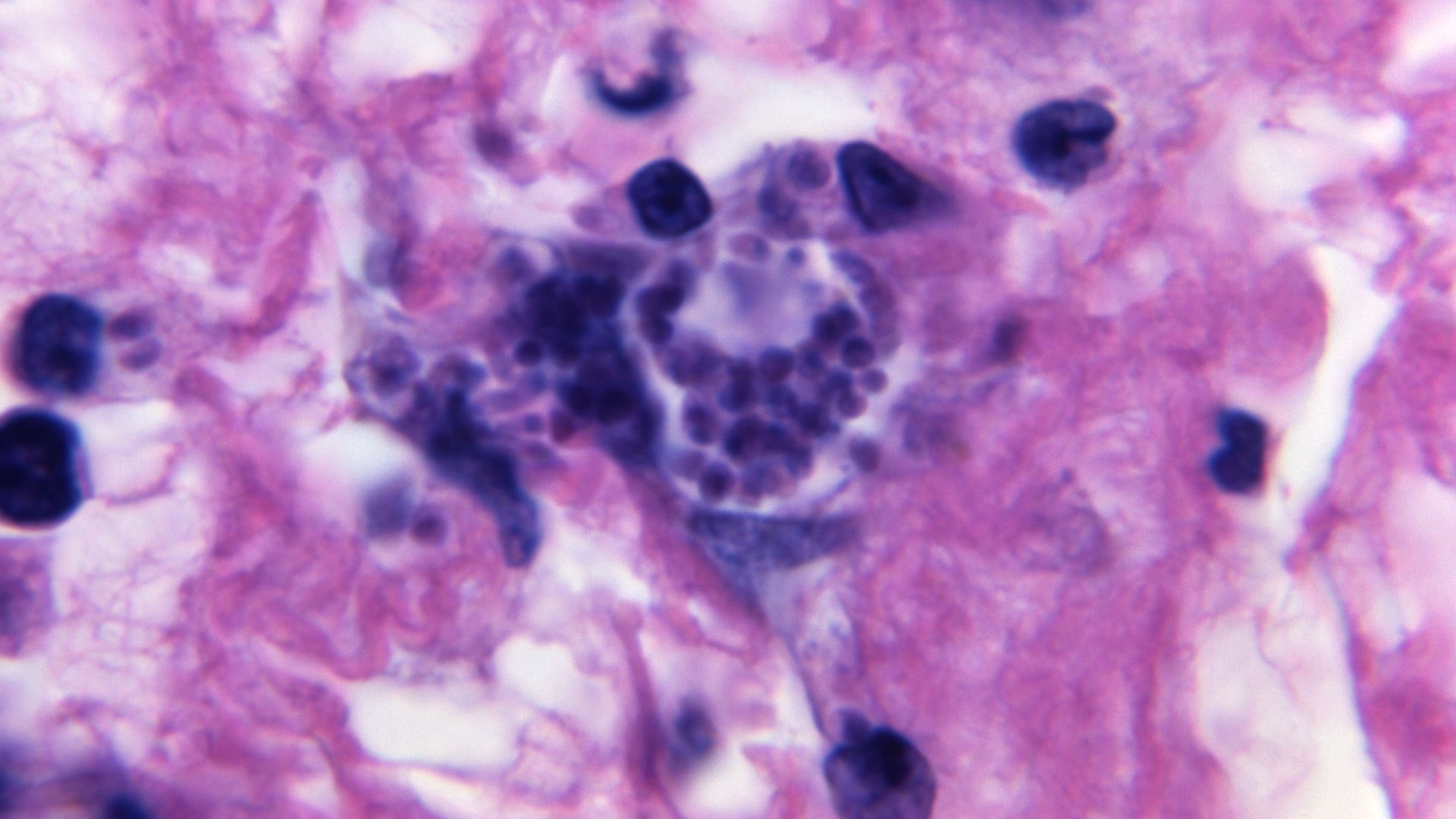 Photomicrograph of a tissue sample, revealed a close view of a darkly stained, Toxoplasma gondii tissue cyst filled with dark purple circles