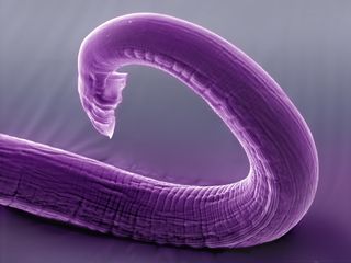 The posterior of a nematode.