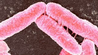 Microscope image of Escherichia coli bacteria in pink against a dark background