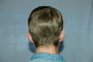 back of male model head with smoothed downhair