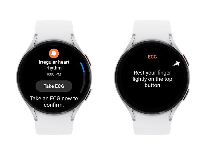 A notification on the Galaxy Watch regarding a potential AFib measurement.