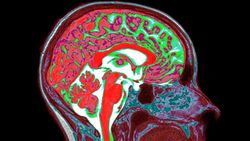 A colorful scan of a human brain, with various regions in red, green or white. 