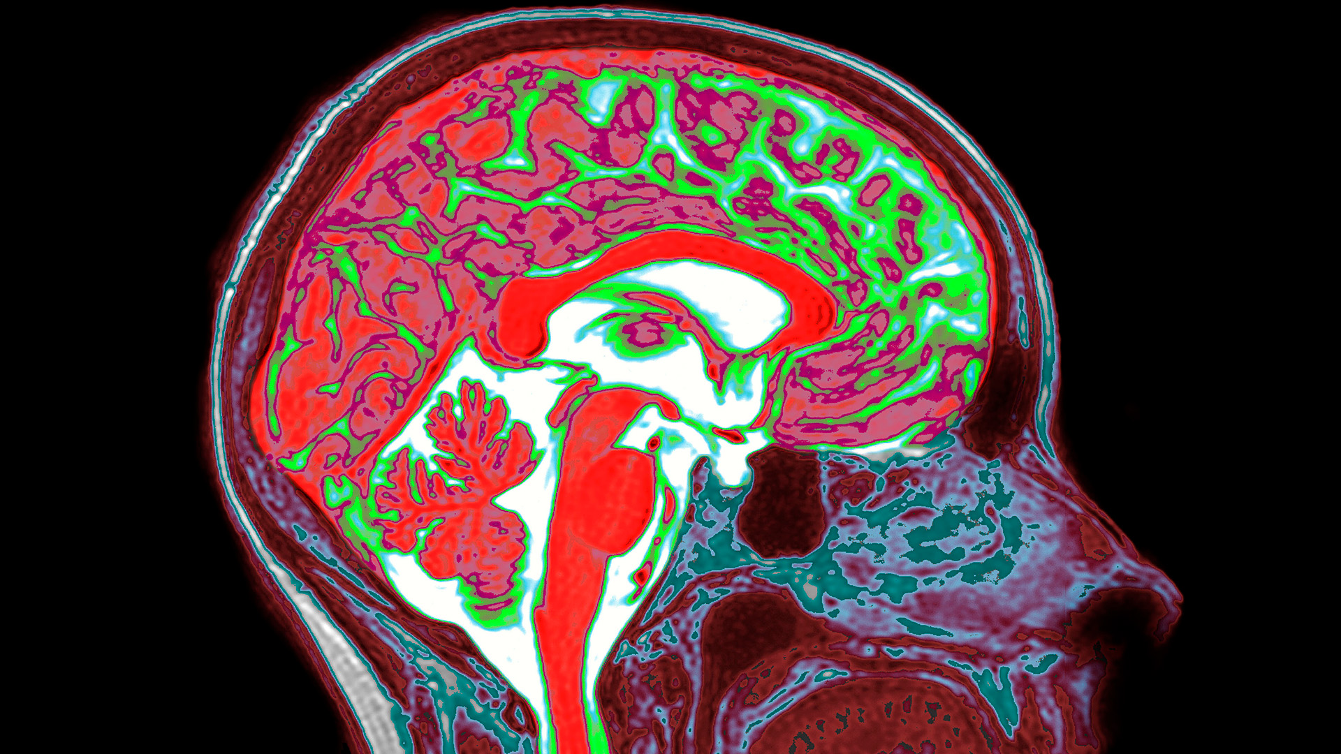 A colorful scan of a human brain, with various regions in red, green or white. 