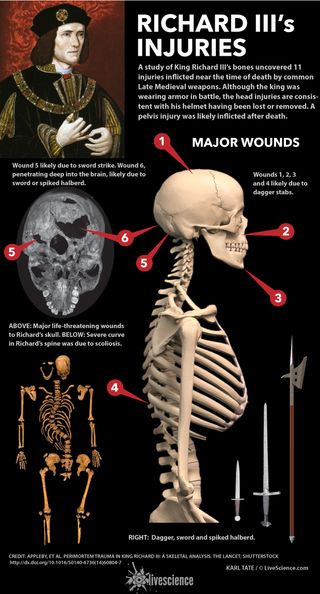 Chart shows dagger, sword and halberd wounds to the king's skeleton.