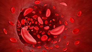 illustration of healthy, round red blood cells and sickle shape blood cells flowing through a blood vessel