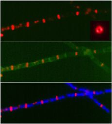 E.coli Cell Division 