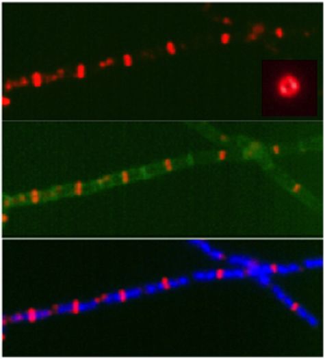 E.coli Cell Division 