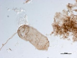 Microfossil that provides evidence of photosynthesis viewed under a microscope.