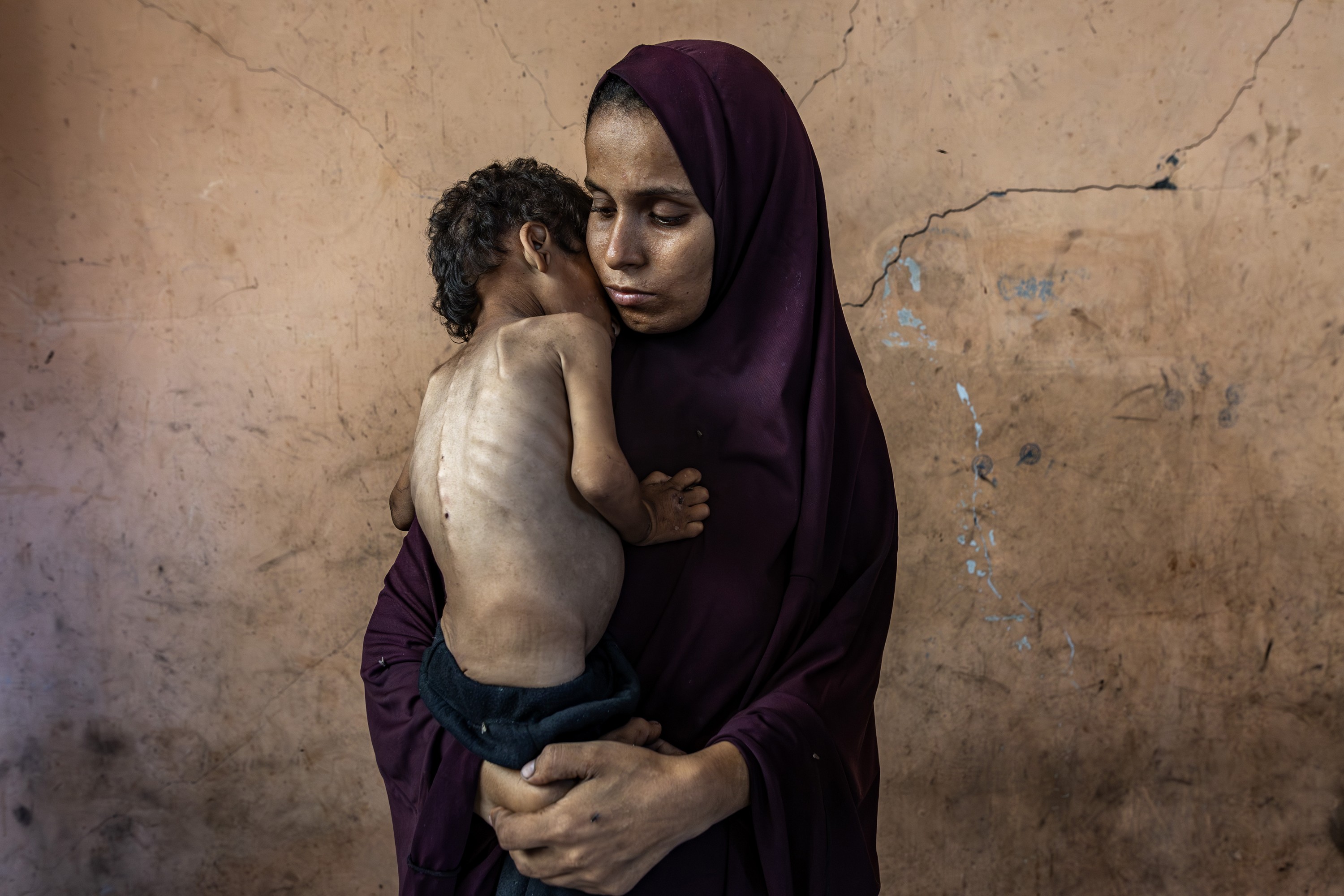 A woman wearing a dark purple hijab gently cradles a severely thin, malnourished child against her chest in front of a cracked, weathered wall.