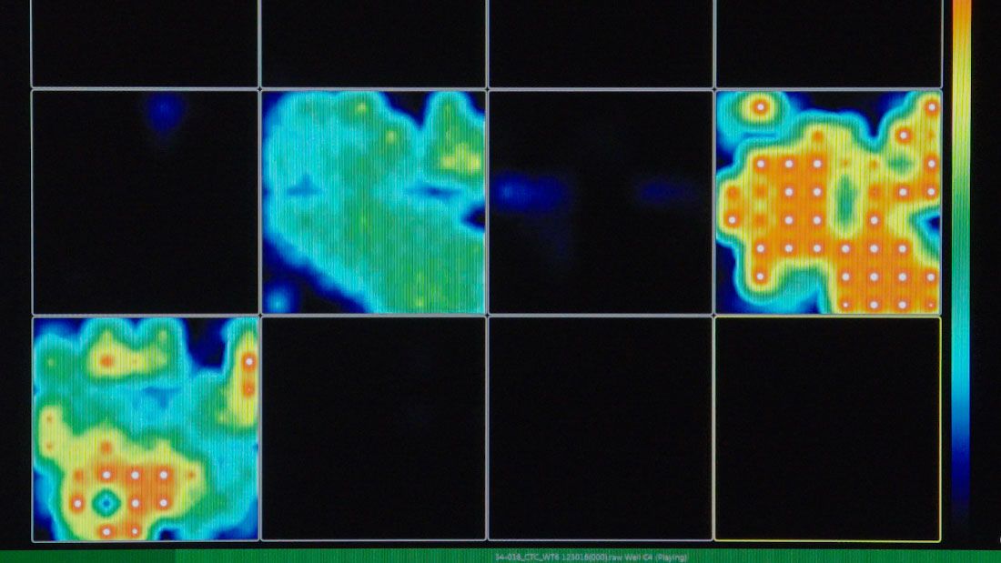 An activity map created by multi-electrode arrays shows how the mini lab brain is active (colored parts) at times and silent (black parts) at other times.