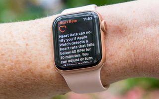 Fitbit Sense just gave us the features we want on Apple Watch 6