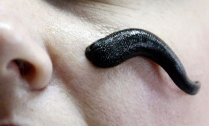 An employee of the International Medical Leech Centre demonstrates with a leech on her face in the village of Udelnaya