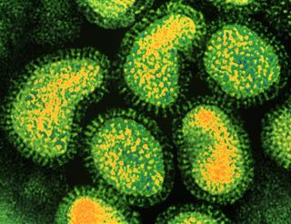 An image of flu virus particles.