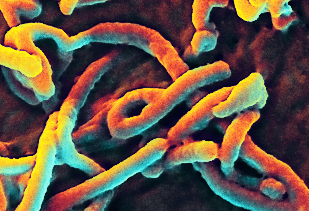 This digitally-colorized scanning electron micrograph (SEM) shows Ebola virus particles budding from the surface of a cell. 