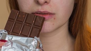 close up of young woman with pimples around her mouth holding up a chocolate bar as if to eat it