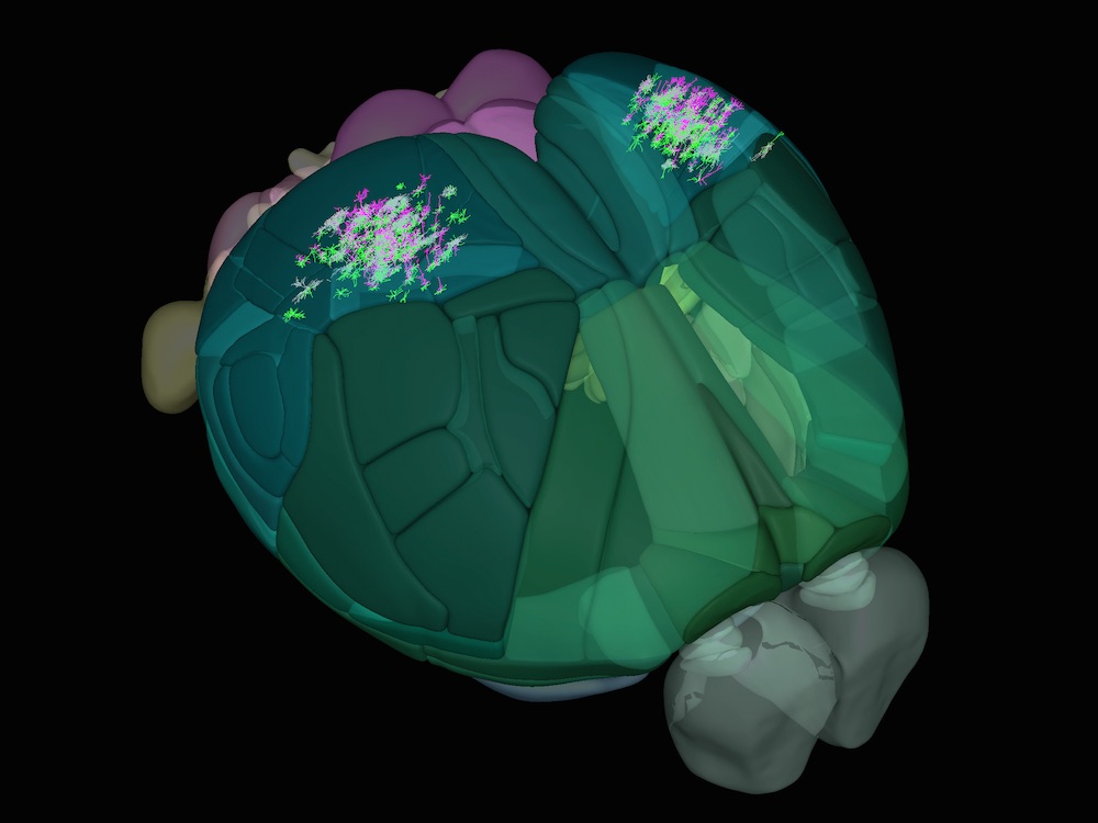 mouse brain