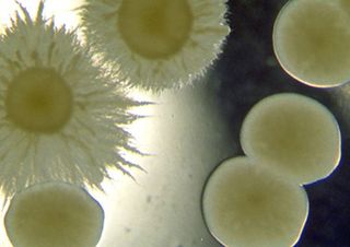 fungi in petri dish