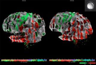 3-D rendering from the Allen Human Brain Atlas