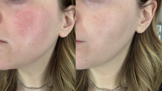 before and after tata harper calming creme