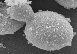 A species of yeast (Saccharomyces cerevisiae) seen in a scanning electrograph image.