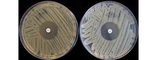 staph infection, bacteria, antibiotics