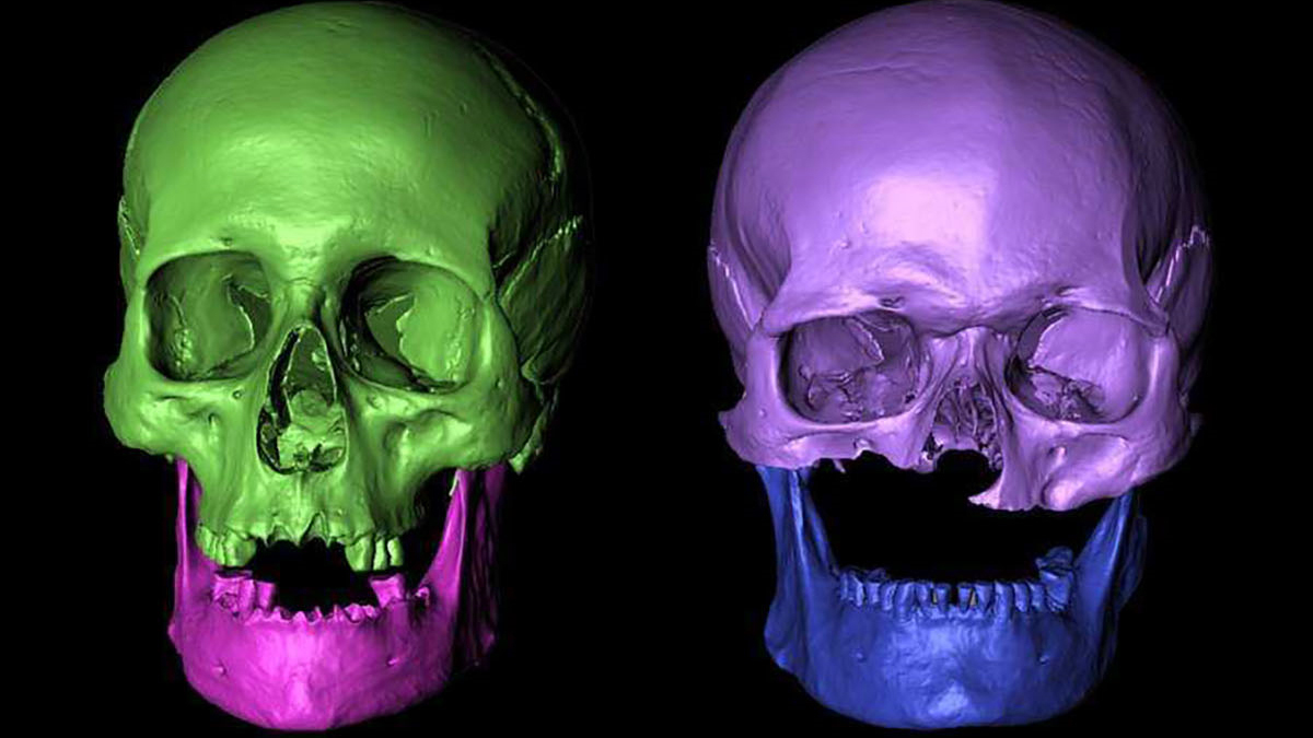 Scientists think the two main burials in the grave date between the late 13th century and the early 15th century; the two men were related, probably cousins or an uncle and nephew.