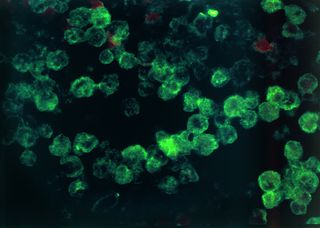 This picture shows an infection of the amoeba Naegleria fowleri, seen under a microscope and stained with a fluorescent antibody.