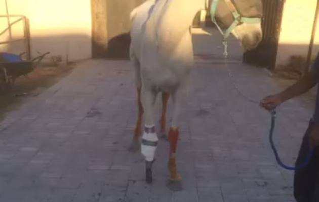 amputation 1