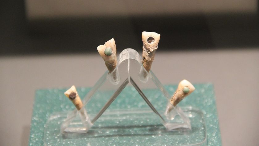 A display of four human teeth with inlaid stones