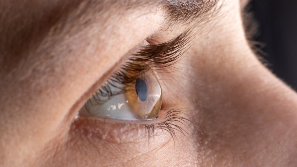 Nerve damage in cornea could be sign of 'long COVID,' study hints - Livescience.com