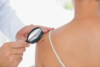 A doctor examines a mole on a woman's shoulder.