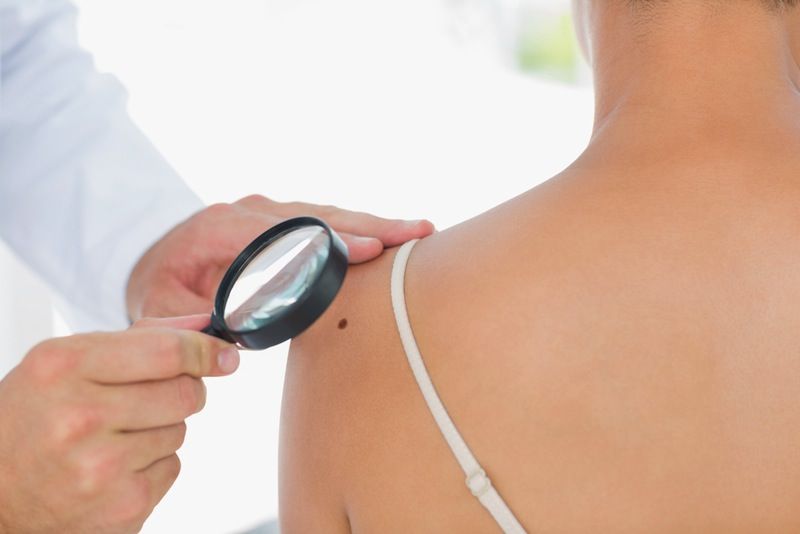 A doctor examines a mole on a woman&#039;s shoulder.