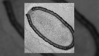 A section of a Pithovirus particle observed by transmission electron microscopy.