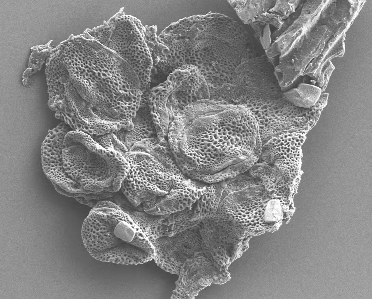 A black and white image showing a blobby grain of pollen under a microscope
